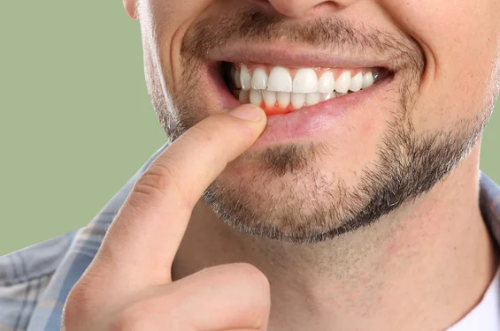 Man smiling broadly while touching his face, displaying healthy white teeth against a green background.