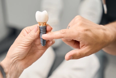 Healing and Osseointegration